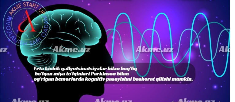 Erta kichik gallyutsinatsiyalar bilan bog’liq bo’lgan miya to’lqinlari Parkinson bilan og’rigan bemorlarda kognitiv pasayishni bashorat qilishi mumkin.