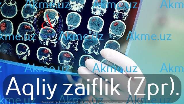 Aqliy zaiflik (Zpr).